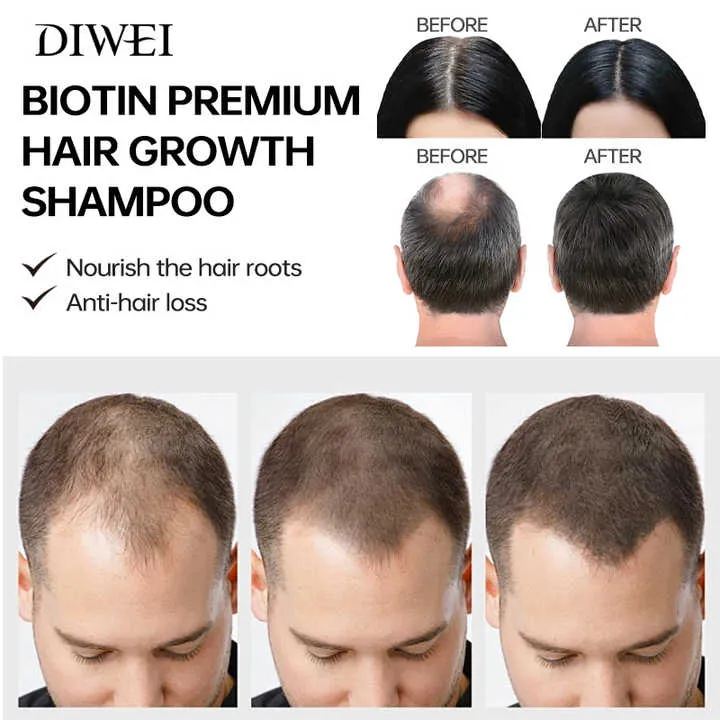 DIWEI Onion Biotin Shampoo-مجموعة شامبو وبلسم