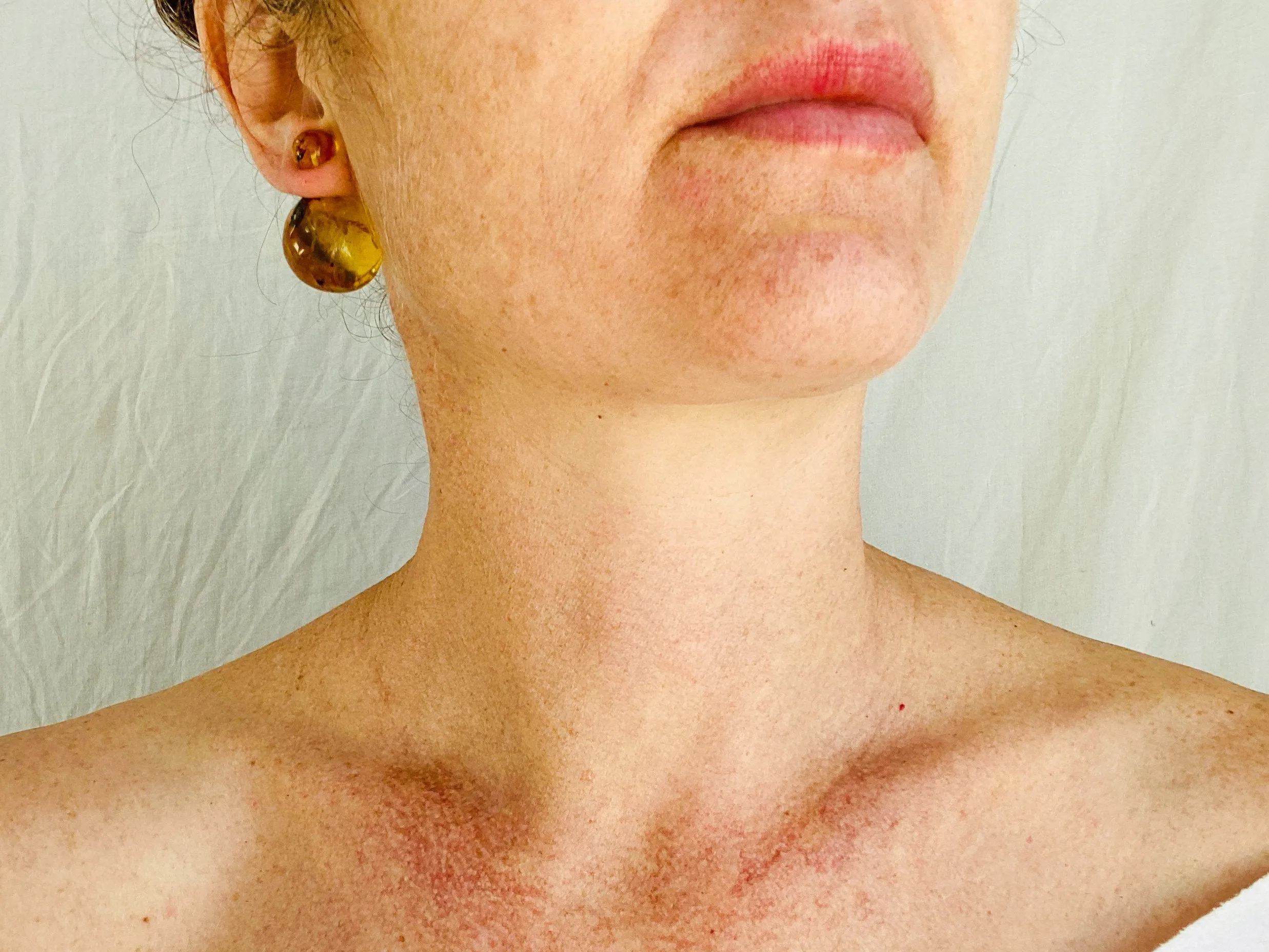 Large Amber Barbell Earrings. Double Sided.