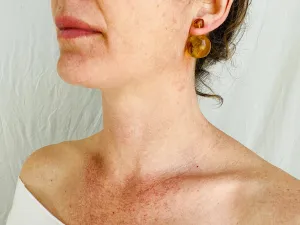 Large Amber Barbell Earrings. Double Sided.
